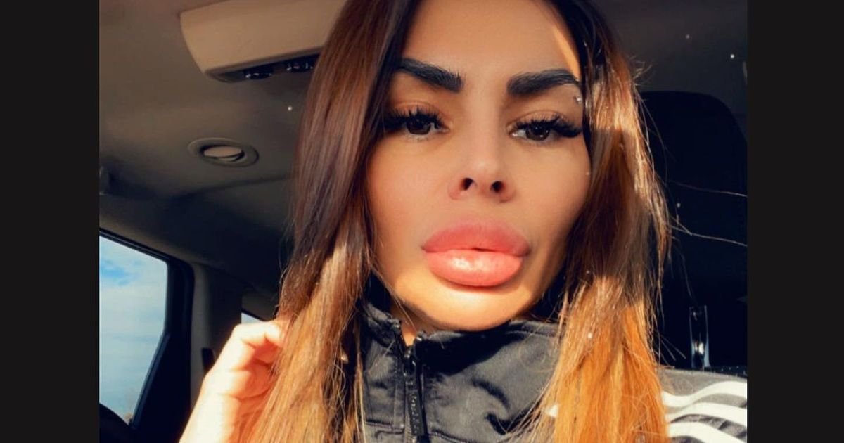 Jovanu partner ostavio u visokorizičnoj trudnoći, ona otkrila kroz šta prolazi "Dobijam jake injekcije..."