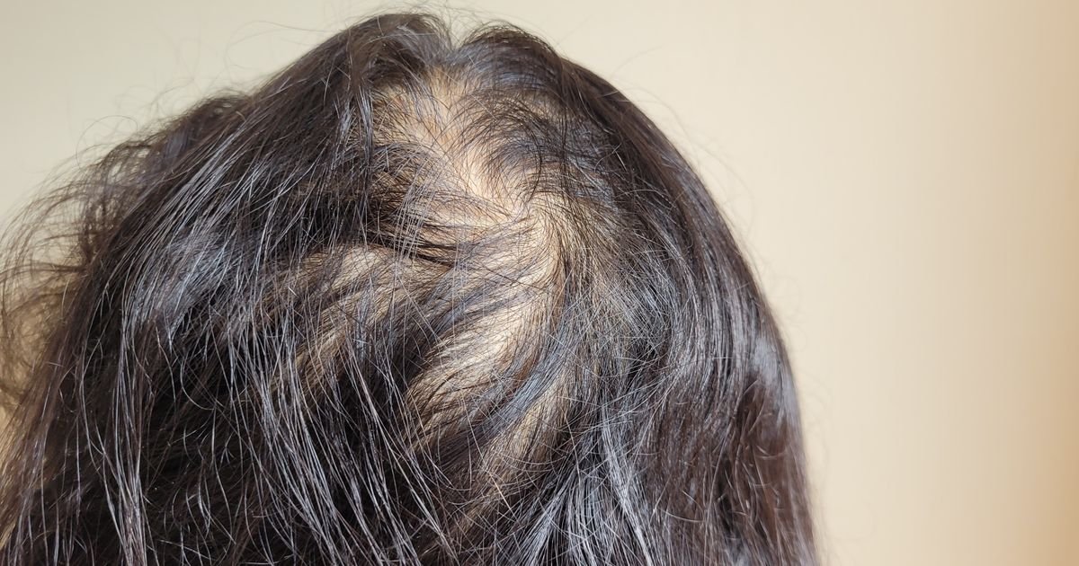 Želite gušću kosu? Ovi prirodni saveti za rast i volumen zaista rade, kažu frizeri