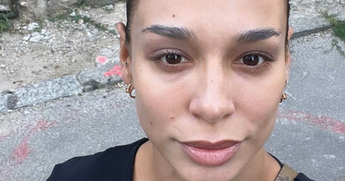 "Imala sam ozbiljan problem" Edita Aradinović o zdravstvenoj agoniji, morala da otkrije: "Više nije tabu tema"