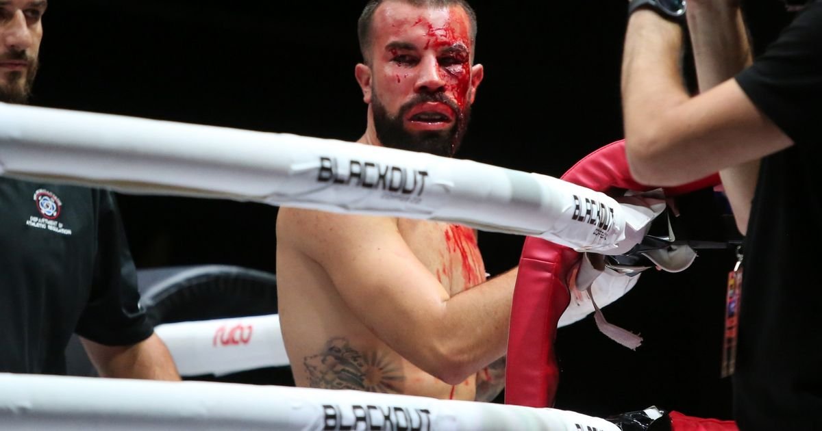 Ovako su izgledala lica Dobrijevićevog i Kocijevog rivala posle borbe golim šakama: Čeka nas krvavi rat!