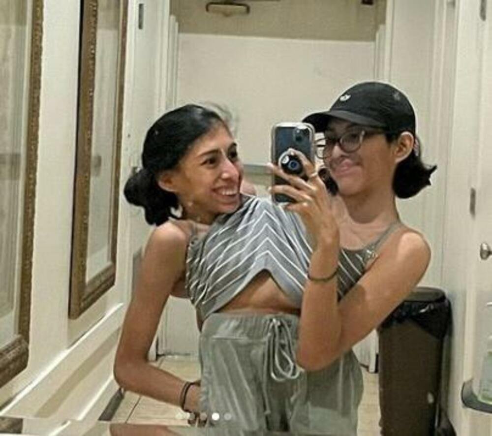 INTIMNI ŽIVOT SIJAMSKIH BLIZNAKINJA IZAZIVA NEVERICU: Dok jedna spava sa dečkom, evo šta ova druga radi pored njih