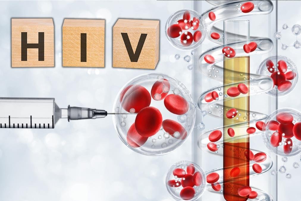 OGLASILO SE MINISTARSTVO: Broj HIV infekcija u Rusiji prepolovljen u poslednjih 10 godina