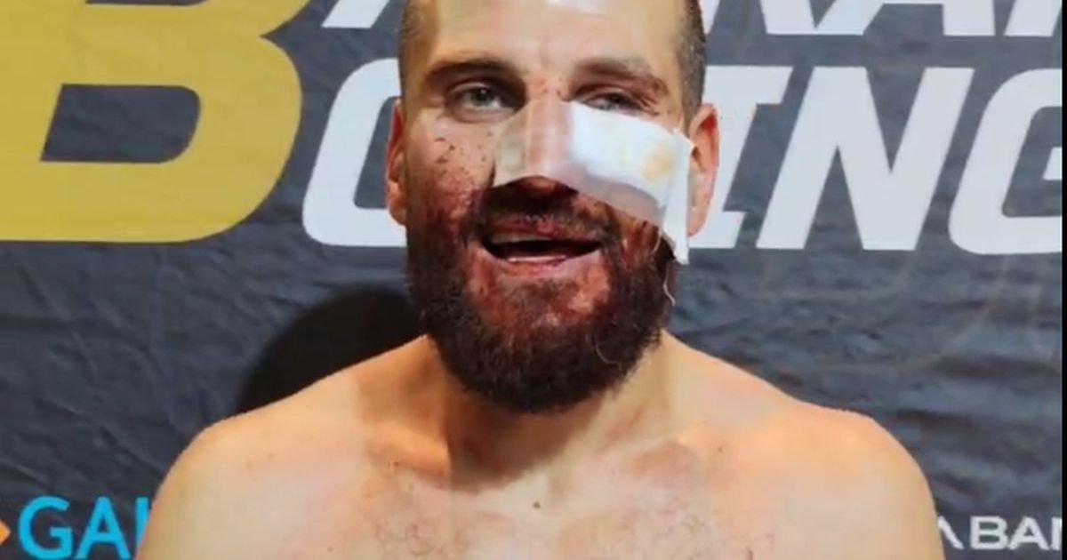 Koci posle fantastične bitke sa Dobrijevićem poručio: "Koju posluku porati, imao sam ga par puta"