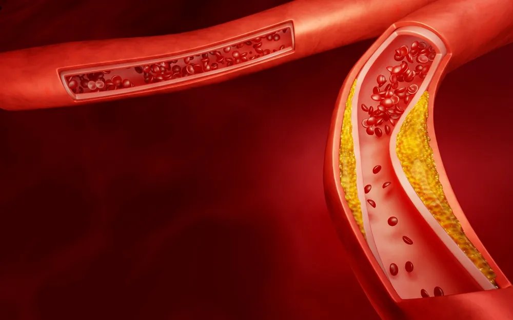 Nutricionisti: Ako želite brzo da snizite holesterol, češće jedite tri namirnice