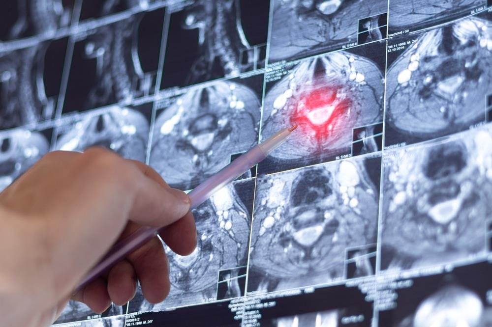 AI precizniji od lekara u hitnim slučajevima? Studija sa Harvarda pokrenula pitanja