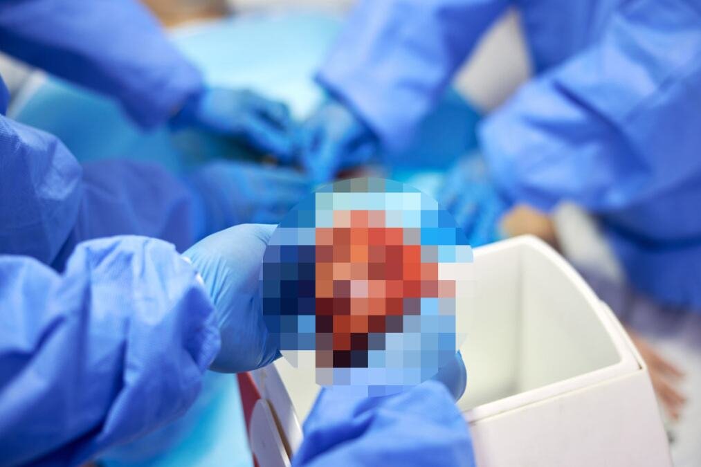 Izmene zakona: Nova pravila o doniranju organa nada su za 1.700 pacijenata koji čekaju transplantaciju