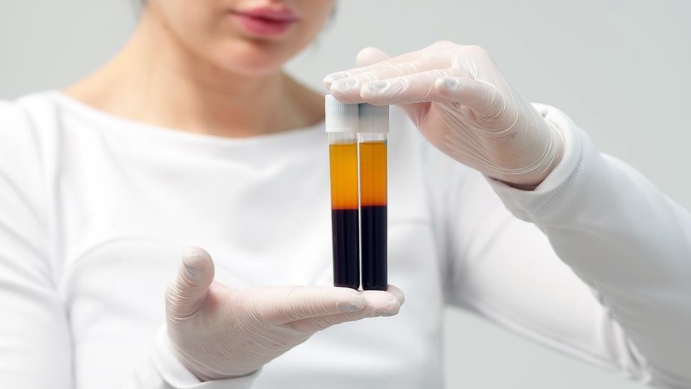 Građani danas mogu dobrovoljno dati krv na tri lokacije: Poziv humanim građanima