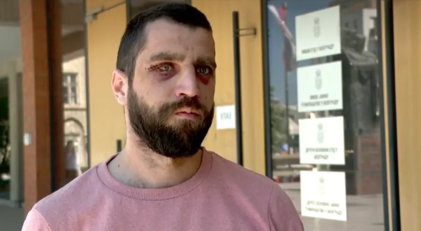 14 dana niko nije uhapšen zbog otmice i brutalnog prebijanja člana Zbora Rakovica u Resniku: Oglasilo se Drugo osnovno javno tužilaštvo
