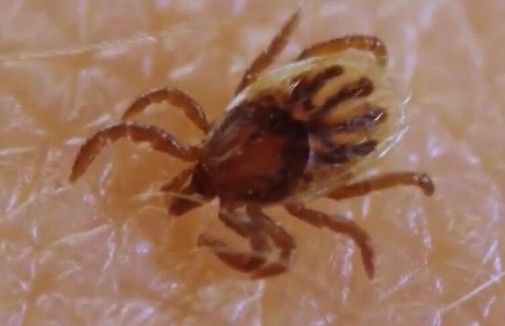 AKO VAS UBODE KRPELJ OVO NIKAKO NE SMETE DA STAVLJATE! "U prvih 24 sata morate samo da..." MOŽE DA BUDE JAKO OPASNO