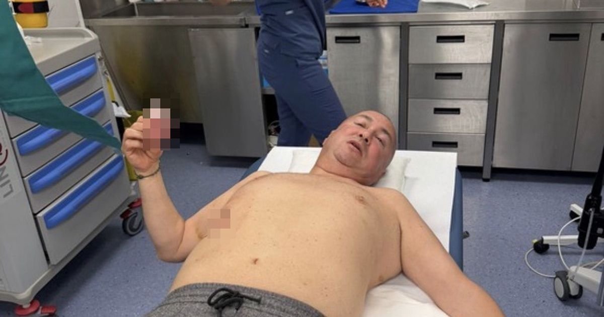 Prva slika Đanija nakon što je izujedan na svadbi: Folker u bolnici, leži bez majice na stolu sa ranom