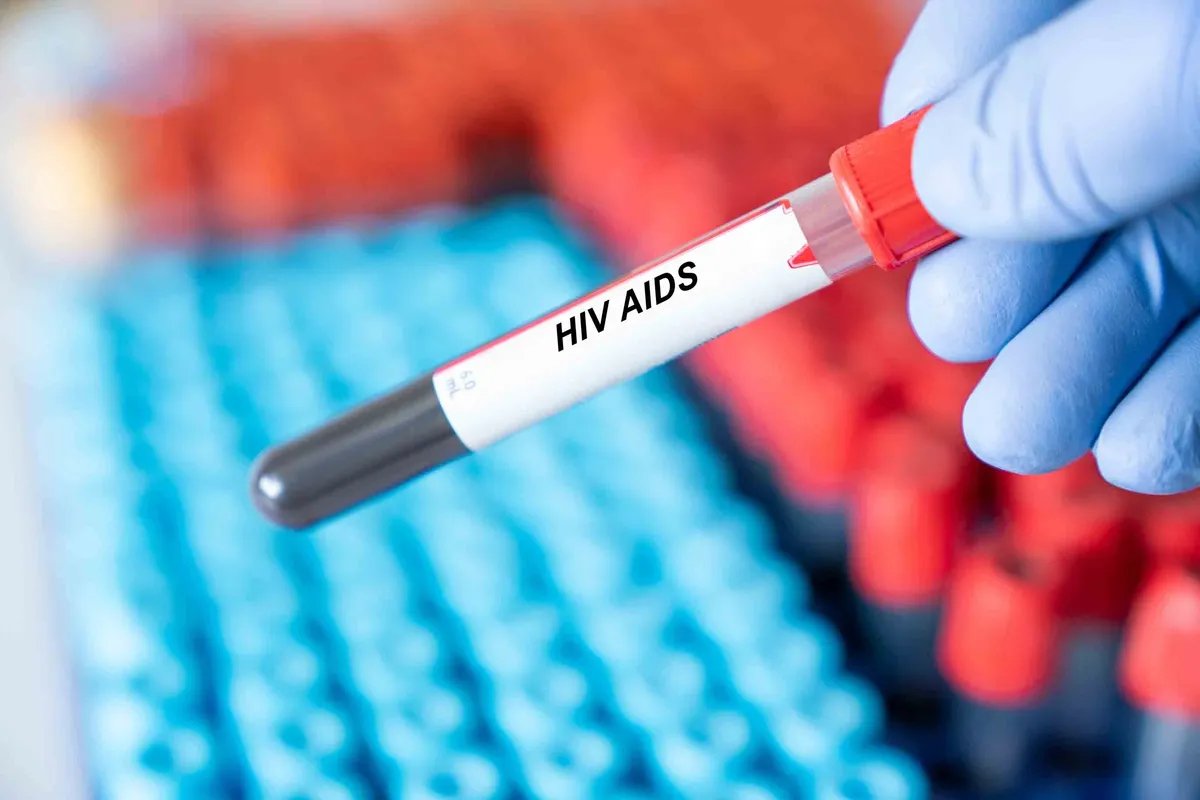 Strah i stigma i dalje udaljavaju ljude od HIV testiranja u Srbiji