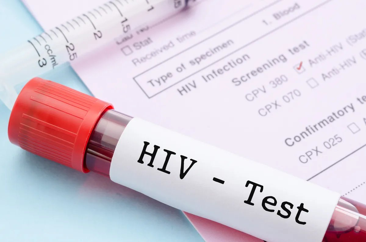 U Srbiji se 3.000 ljudi leči od HIV-a: Strah i stigma i dalje udaljavaju ljude od testiranja