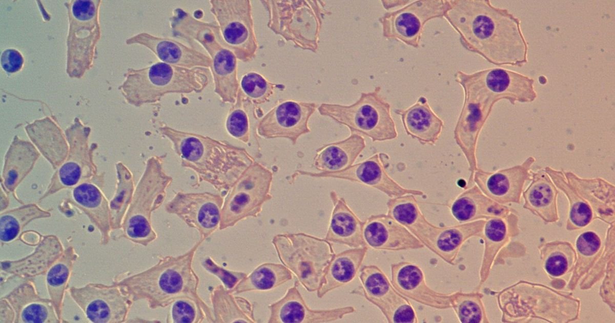 Zombi ćelije nisu uvek štetne