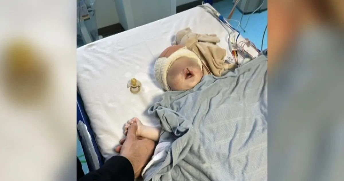 Tata Luka vrisnuo, babica pretrnula od šoka na porođaju: Ovom mališanu su četiri meseca bile zašivene oči