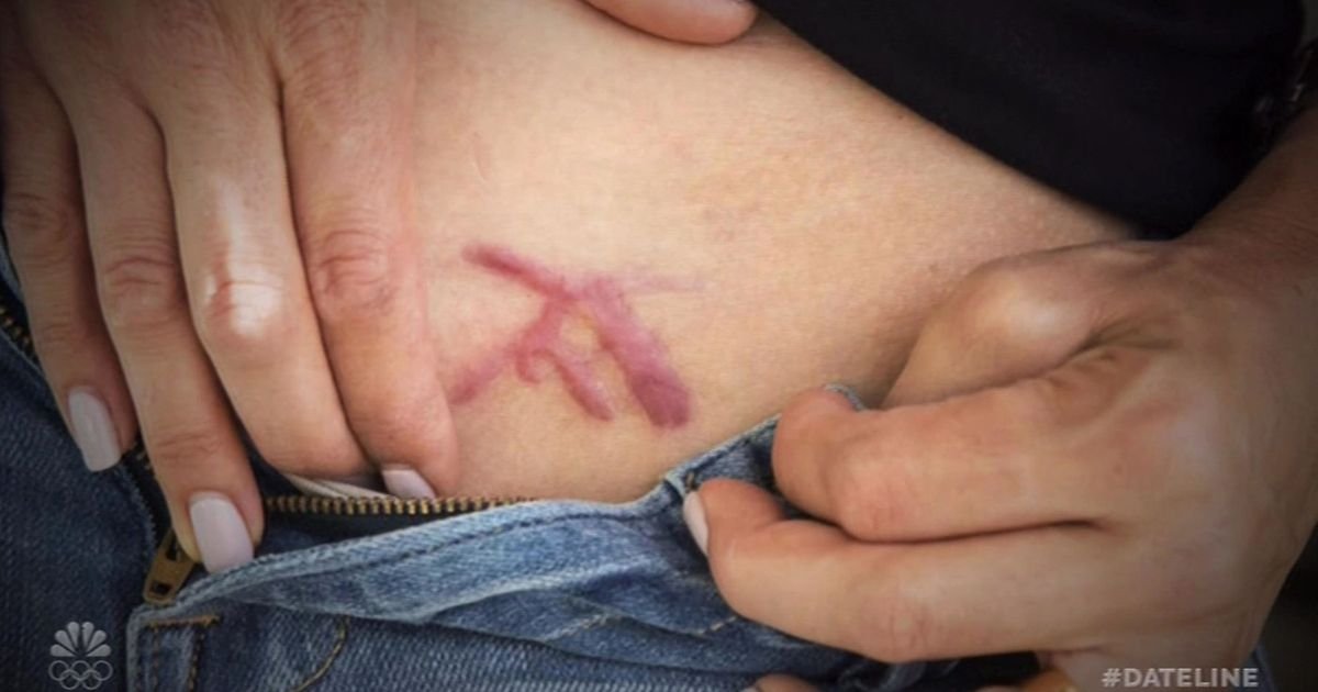 "Bila sam u zloglasnom NXIVM kultu, ŽIGOSALI SU ME USIJANIM GVOŽĐEM i terali da..." Strašna ispovest Sare