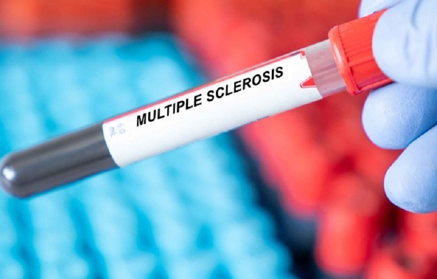 Srbija dobija Centar za multiplu sklerozu i srodne bolesti