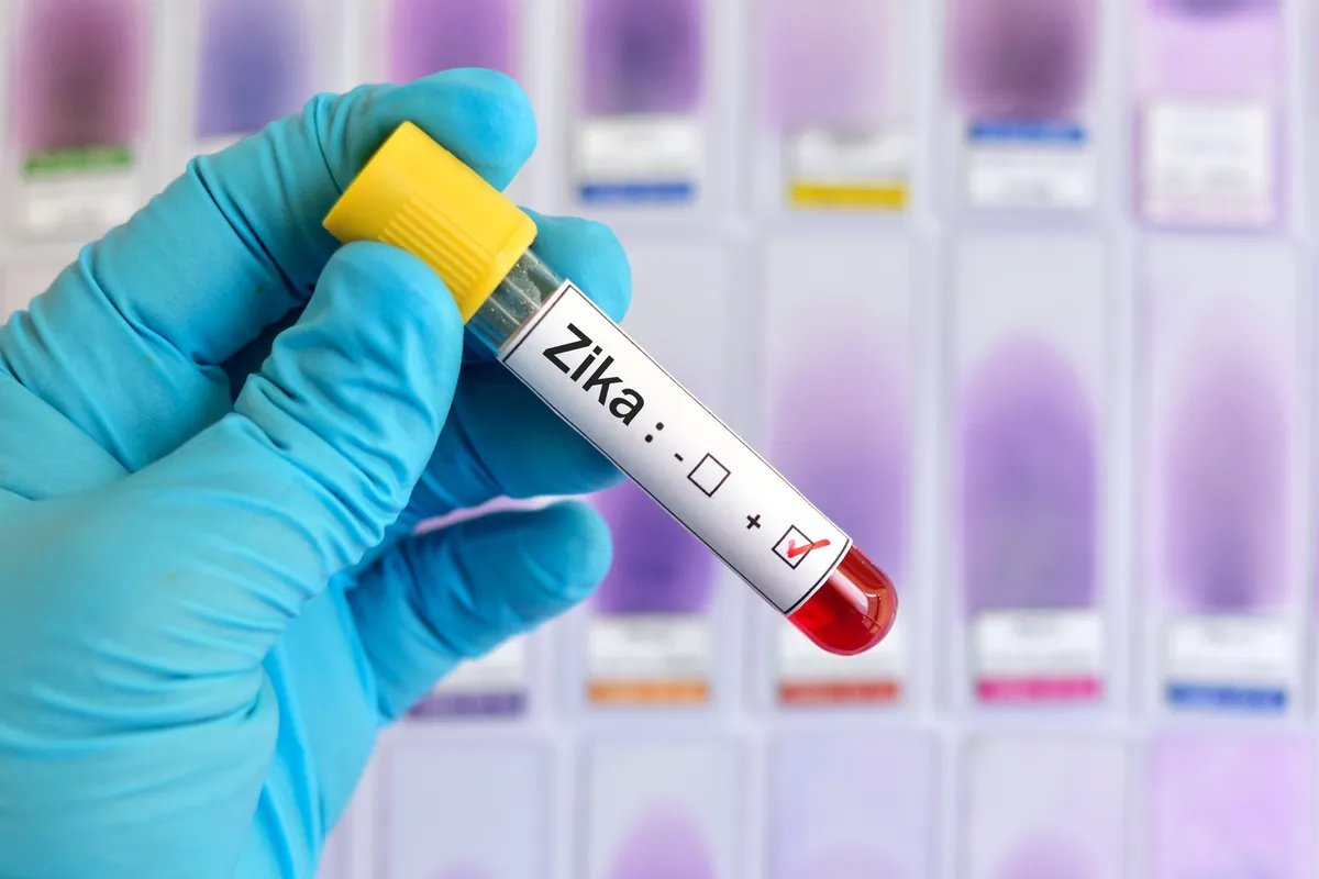 Delić: Denga, zika i čikungunja - tri virusne infekcije koje će globalno otopljavanje doneti u Srbiju