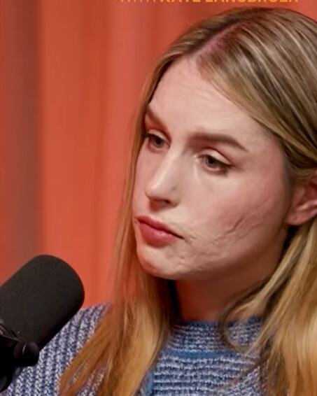 "Molila sam Boga da me neko ubije samo da bol prestane": Stefani je preživela erupciju vulkana, a onda joj je majka saopštila najgore vesti "Onesvestila sam se"