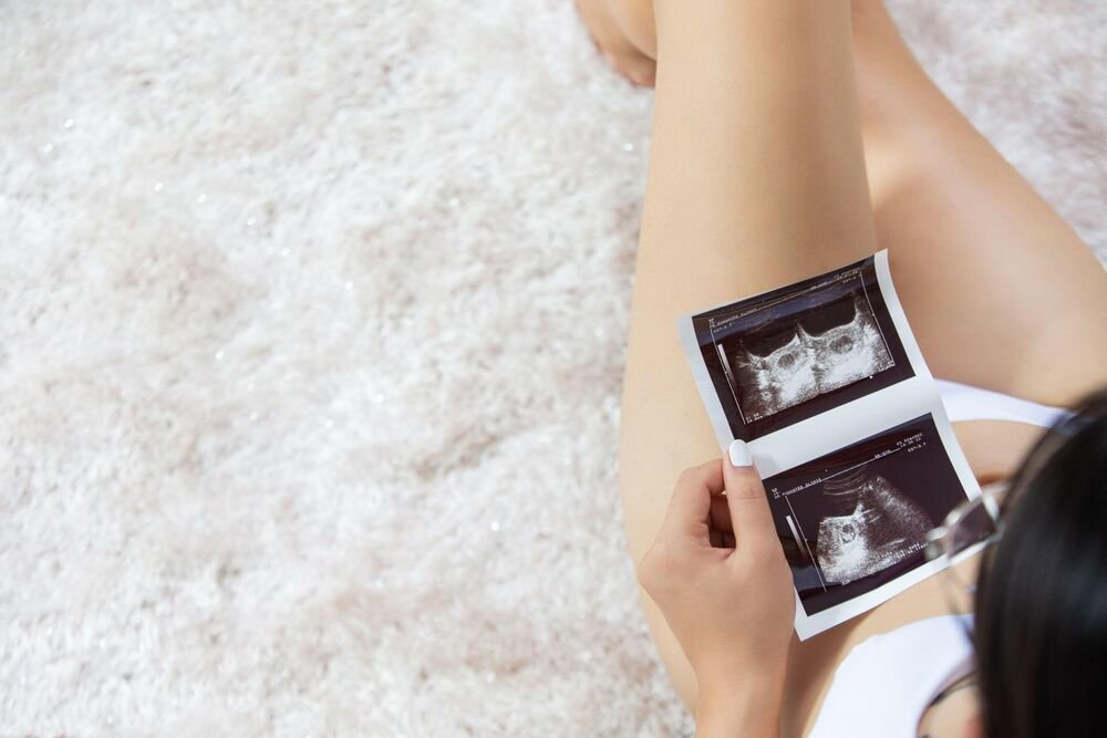 IRINU SVEKRVA MARIJA NATERALA DA ABORTIRA, A ONDA JU JE POTEZ MUŽA ZABETONIRAO! Ono što ju je snašlo ŠOKIRA!