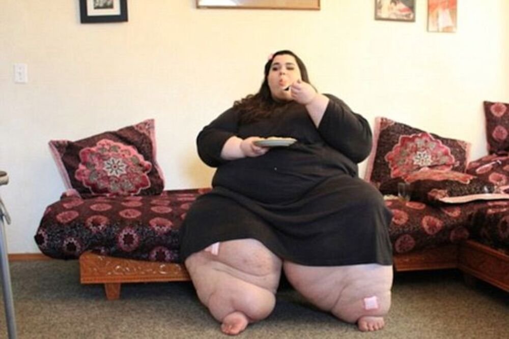 DAVALI JOJ PAR MESECI ŽIVOTA, A ONDA JE SMRŠALA VIŠE OD 200 KILOGRAMA: Jednu stvar ipak ne može da sakrije (FOTO)