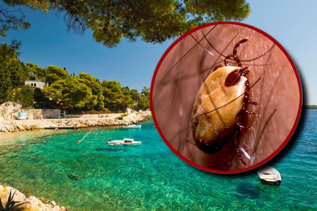 AGRESIVAN KRPELJ SE ŠIRI JADRANOM, PRENOSI OPASNU BOLEST: Zaraženo i trogodišnje dete! Prvo krene temperatura, pa glavobolje, a posledice mogu trajati GODINAMA