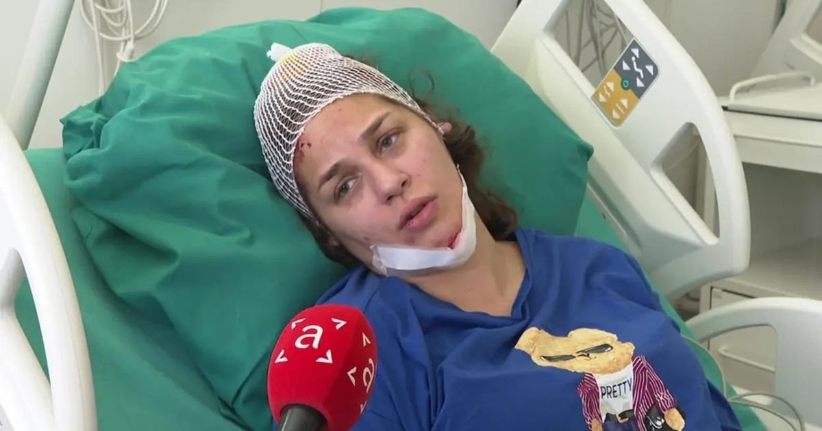 Oglasila se Anja Ljubojević nakon teške nesreće: "Vozača sam pustila da ode, snosim odgovornost..."