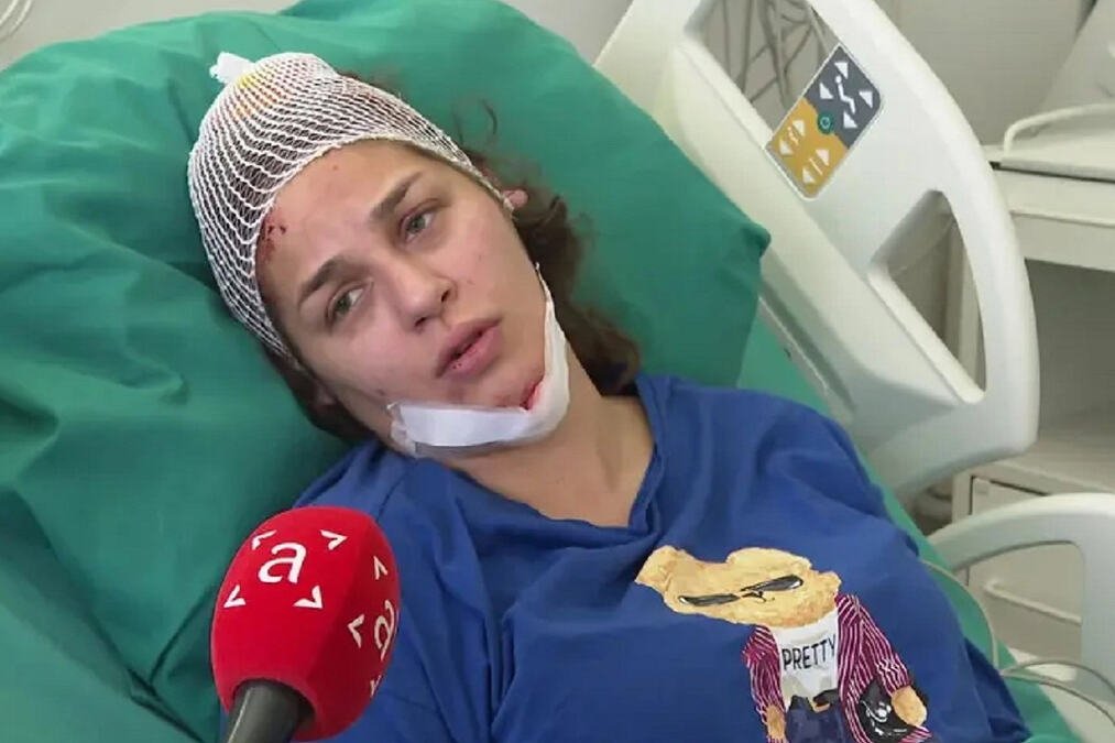 "BILA SAM NA FEŠTI, POPILA PAR PIĆA, SNOSIM SVU ODGOVORNOST" Objavljena fotografija povređene Anje Ljubojević, a "audi" je SMRSKAN! (FOTO)