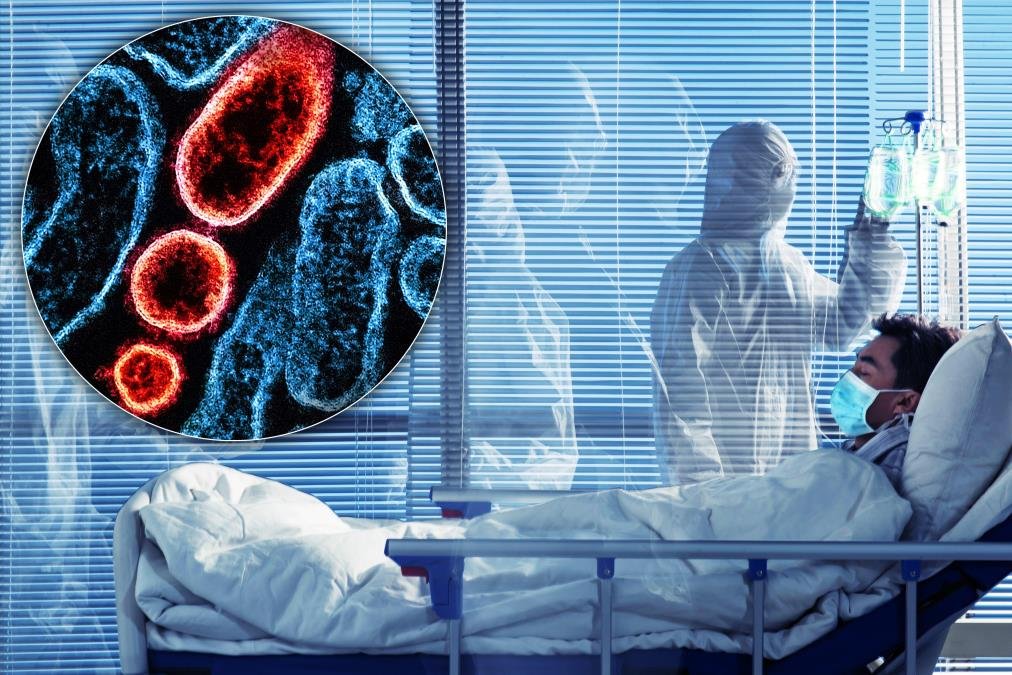 PANIKA U EVROPSKOJ DRŽAVI, OTKRIVEN NOVI VIRUS! Tihi ubica vreba iz trave, prenosi ga životinja sa kojom se svakodnevno susrećemo naučnici u šoku