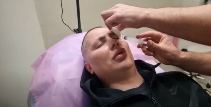Bio najbolji frajer u rijalitiju, pa mu doktori unakazili lice: Izobličio se i naduo, pa nestao iz javnosti