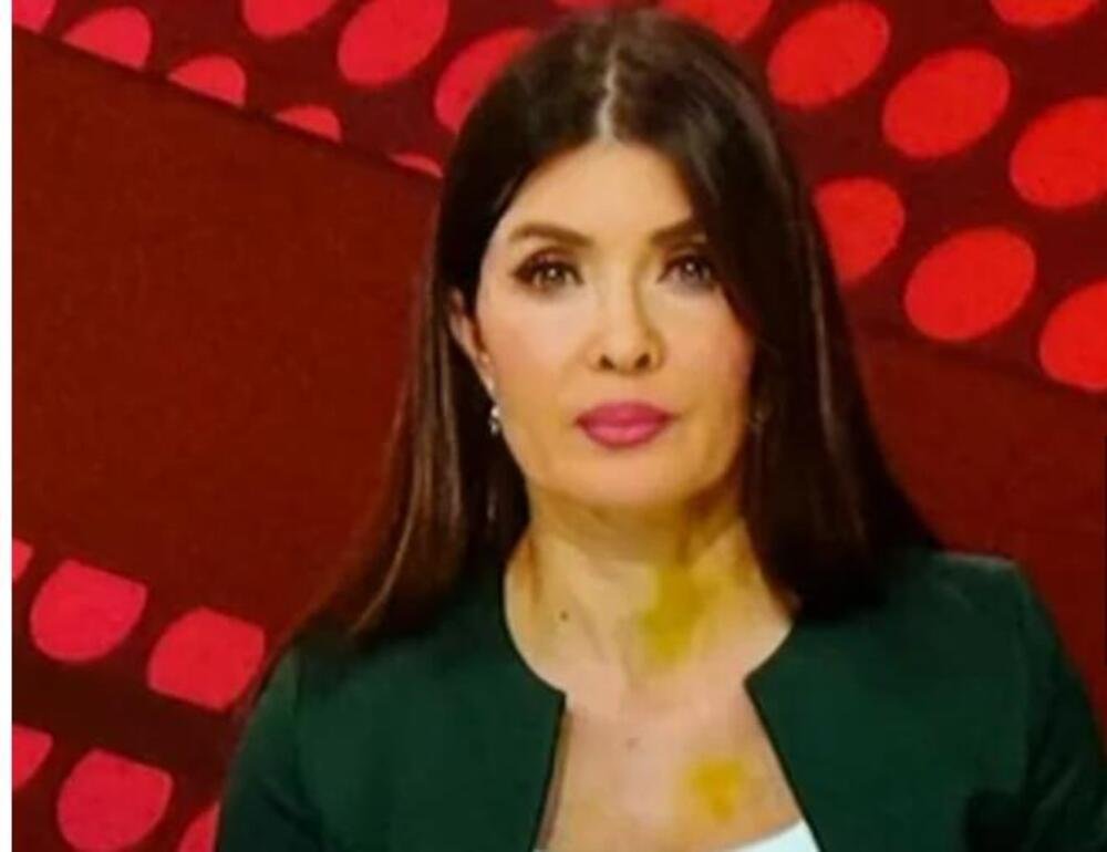 Cela Srbija brujala je o žutim mrljama na vratu voditeljke RTS-a: Svi mislili da su modrice, sad isplivala istina