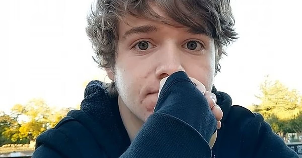 Mladi radnik Mekdonaldsa na koga je kolega prosuo ulje: "Jedna od najgorih stvari koja mi se desila u životu "
