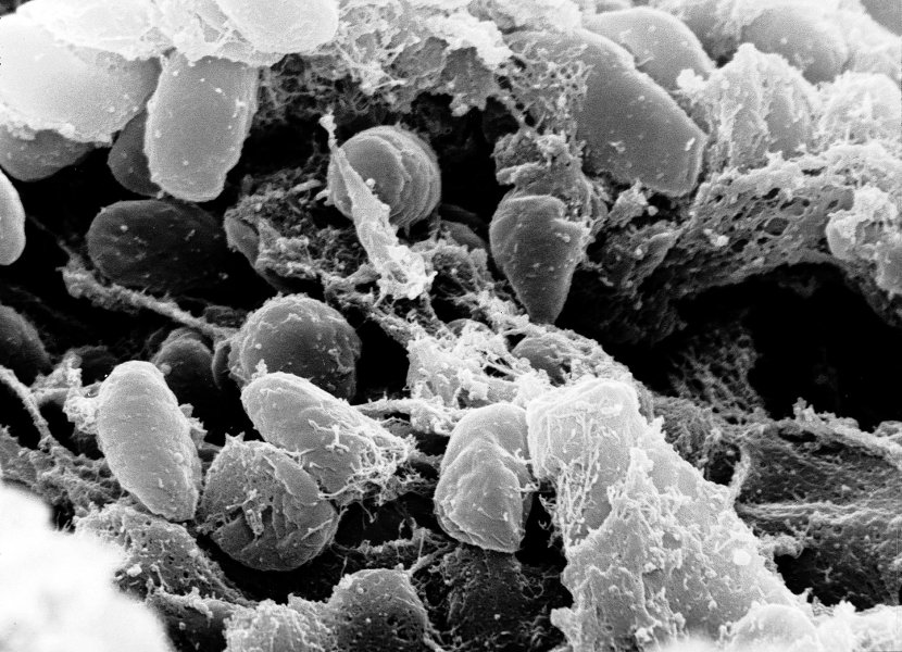 Analizirani ostaci lovaca-sakupljača iz Sibira: Kuga izazivala smrtonosne epidemije i pre 5.500 godina