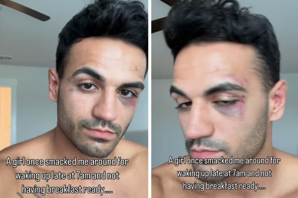 Žalio se da ga je "devojka" udarila jer joj nije spremio doručak: Ljudi skočili da ga brane, a onda je pokazao kako ona izgleda i šokirao sve